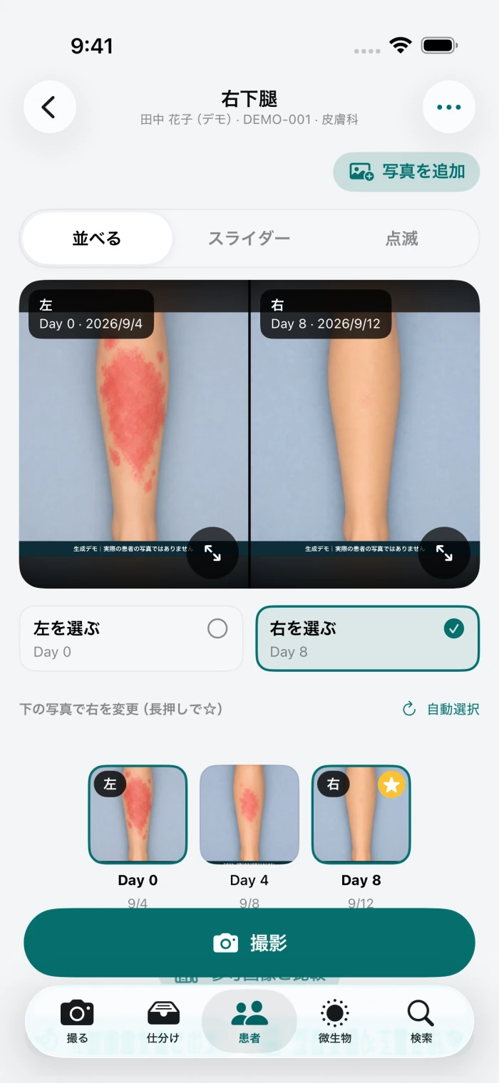 同じ部位の生成画像を左右で比較するiOSアプリの画面